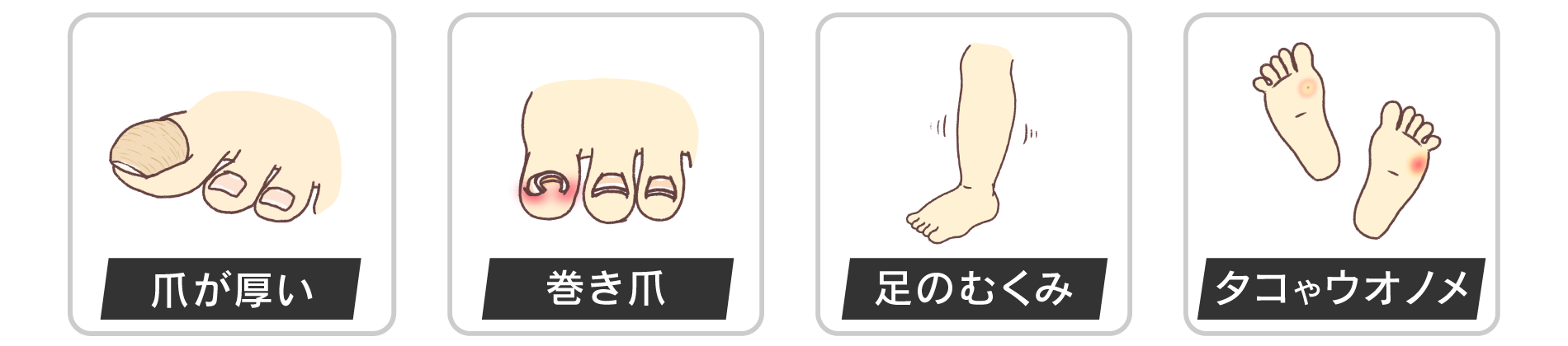 爪が厚い・巻き爪・足のむくみ・タコやウオノメ